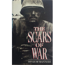 The Scars of War.